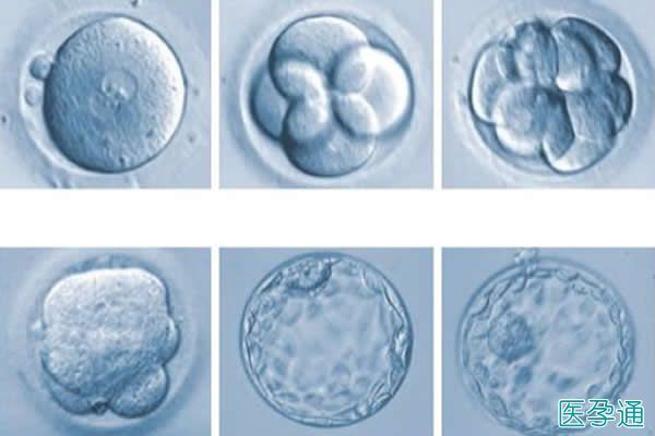 试管婴儿过程中胚胎的分级和评分你必须知道！
