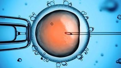 中山双胞胎借卵:男性无精子症如何治疗？