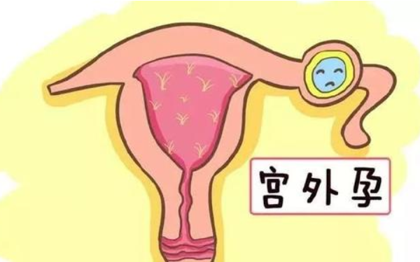 深圳做试管婴儿哪家医院最好-试管婴儿能帮助有宫外孕史的患者实现怀孕吗？