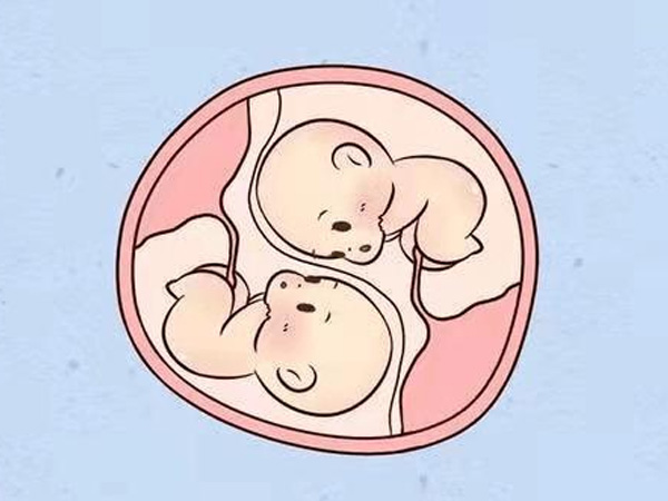 济南助孕龙凤胎咨询-预告你需要知道的格鲁吉亚三胞胎试管婴儿的费用